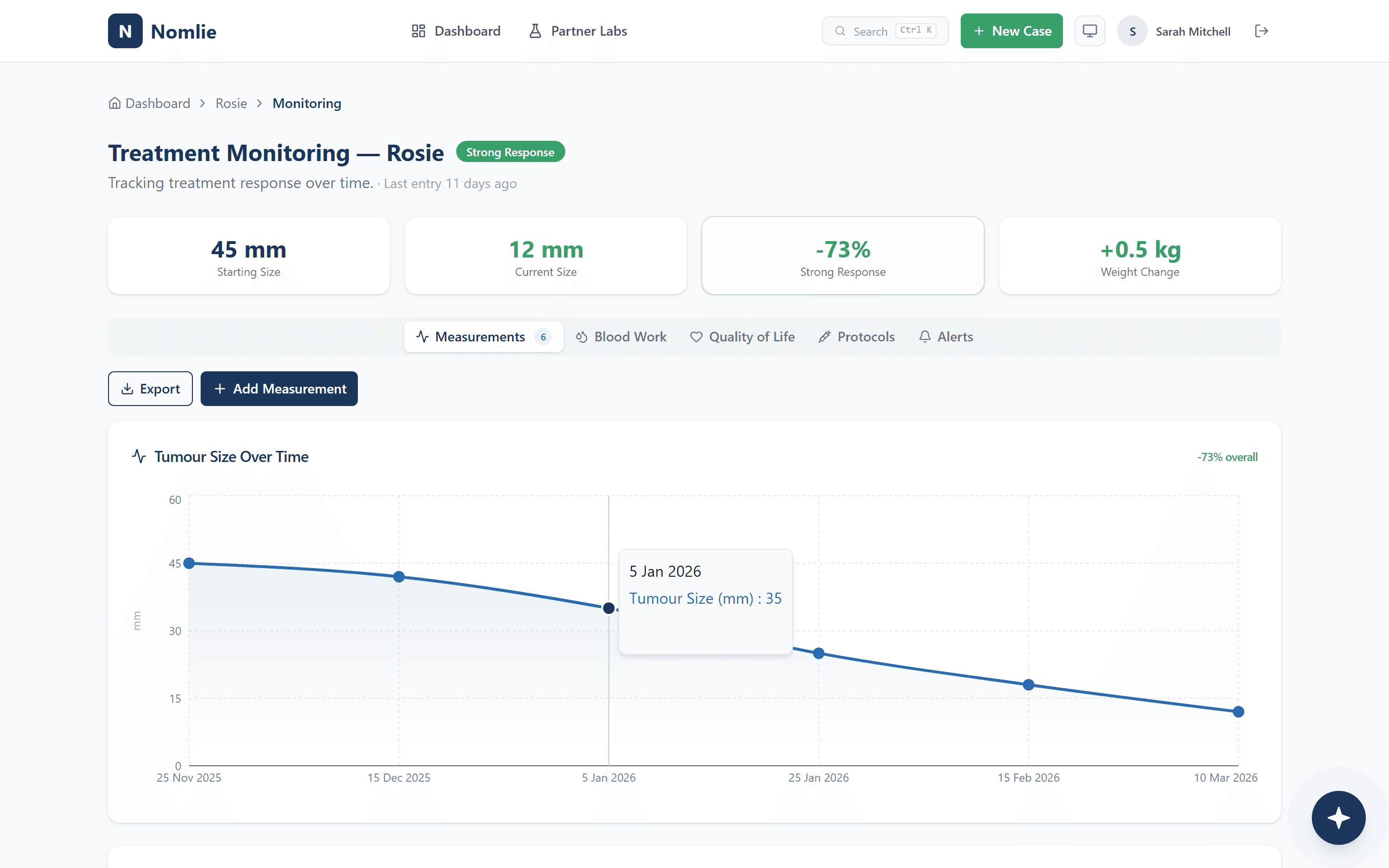 Treatment monitoring showing 73% tumour reduction